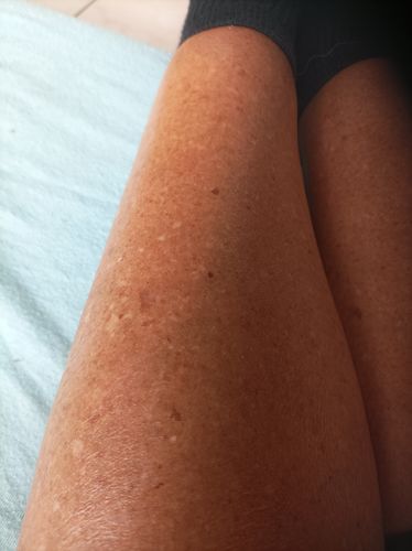 Golden legs of a customer after the S+ SUN course