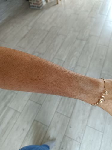 Tanned forearm of an S+ SUN customer