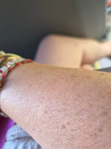 Tanned arm of a customer after the S+ SUN course